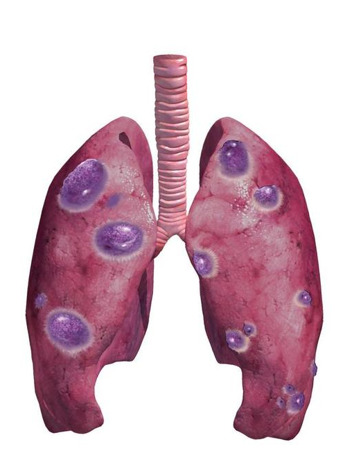 10 critical points from epic security manifesto inability